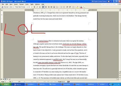 I'm writing a paper on hearing loss. I'm writing a paper on hearing loss.