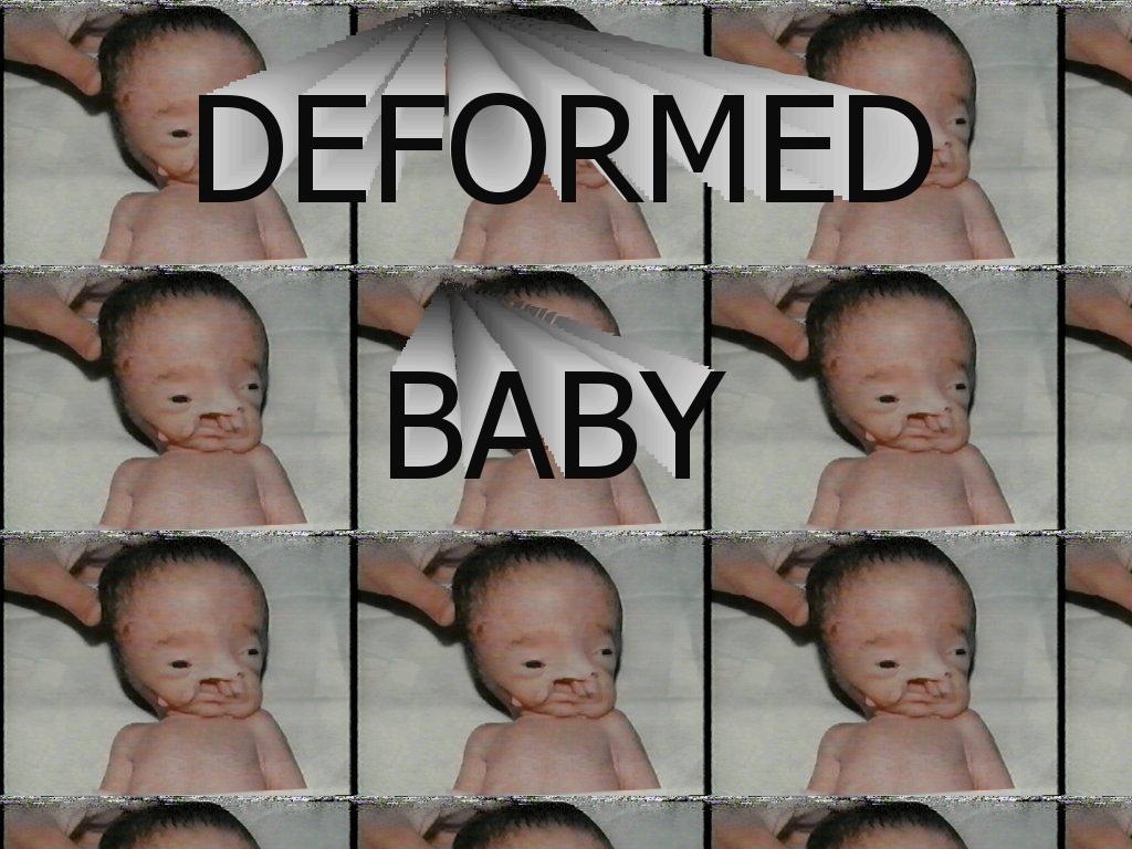 deformedbaby