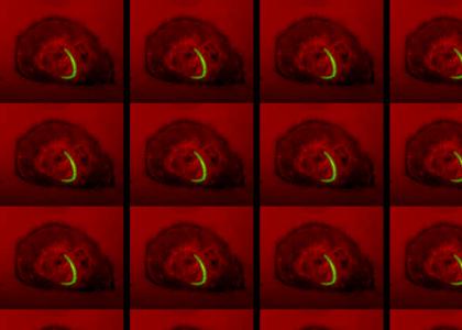 Having a wonderful intracellular time