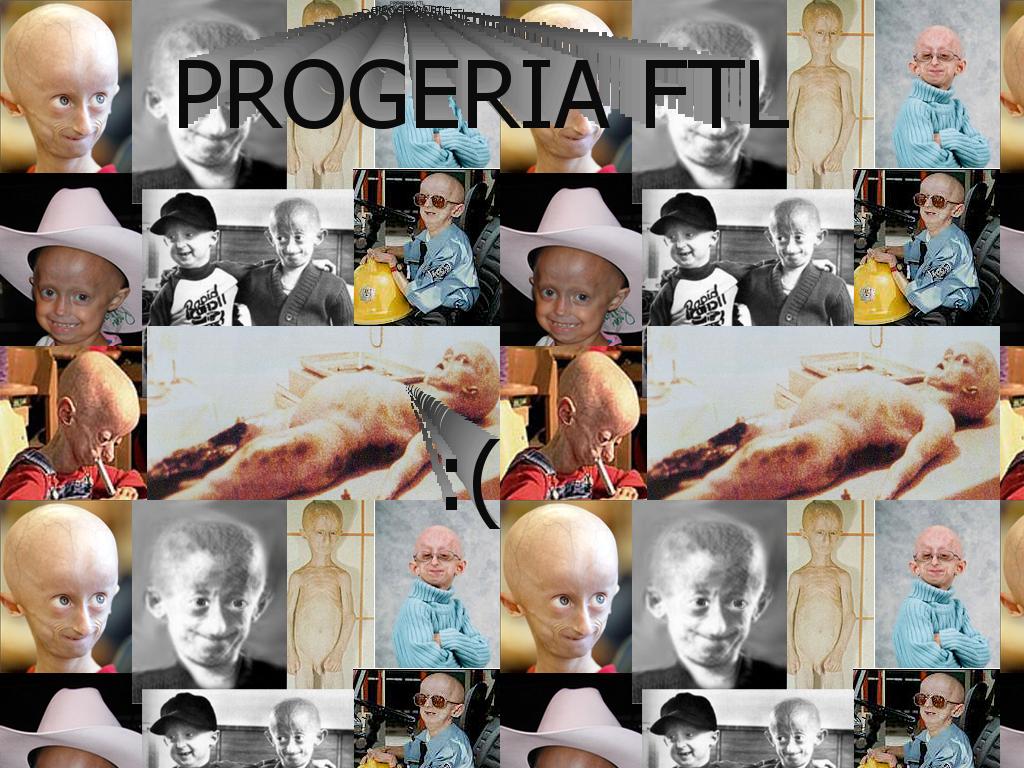 progeria