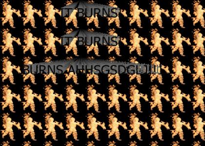 IT BURNS IT BURNS! BURNS AHHHDSGHJKSG!11