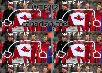 lol, Canadian Camel Toes