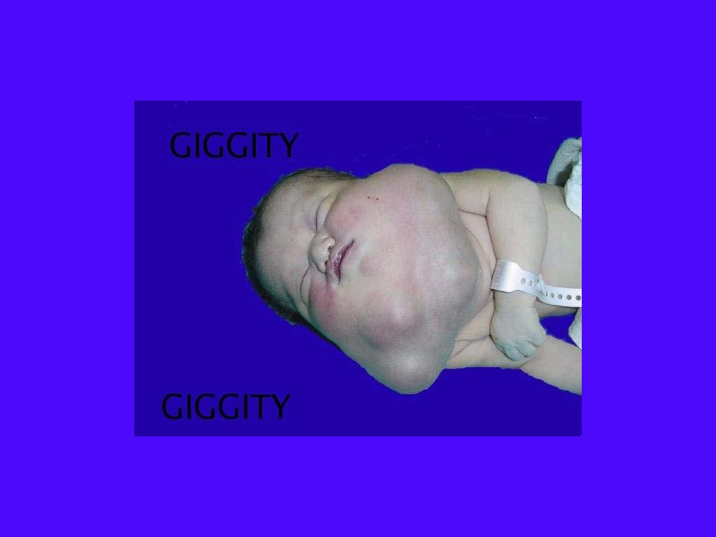 giggitygaagaa