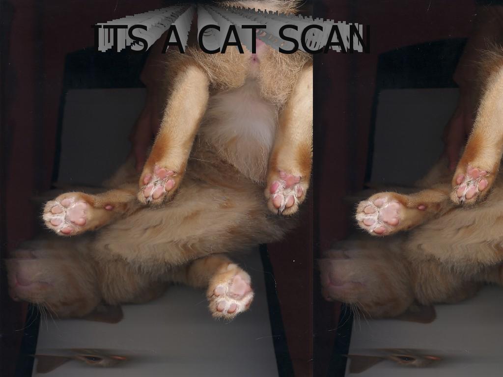 catscan