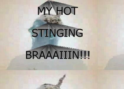 MY HOT STINGING BRAIN