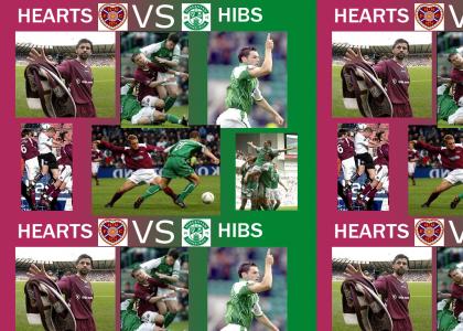 Edinburgh Derby - Hearts vs Hibs