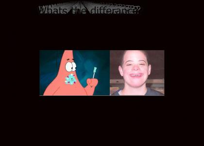 Patrick Star has Down Syndrome