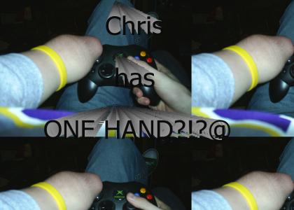 chris has one hand?