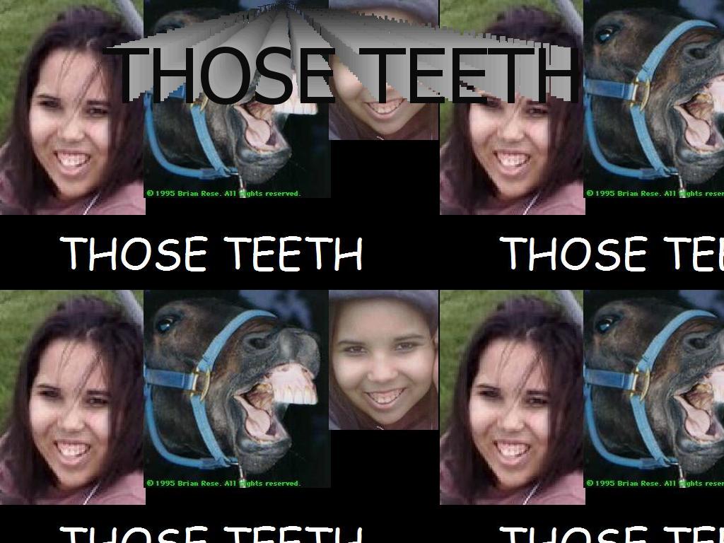 thoseteeth