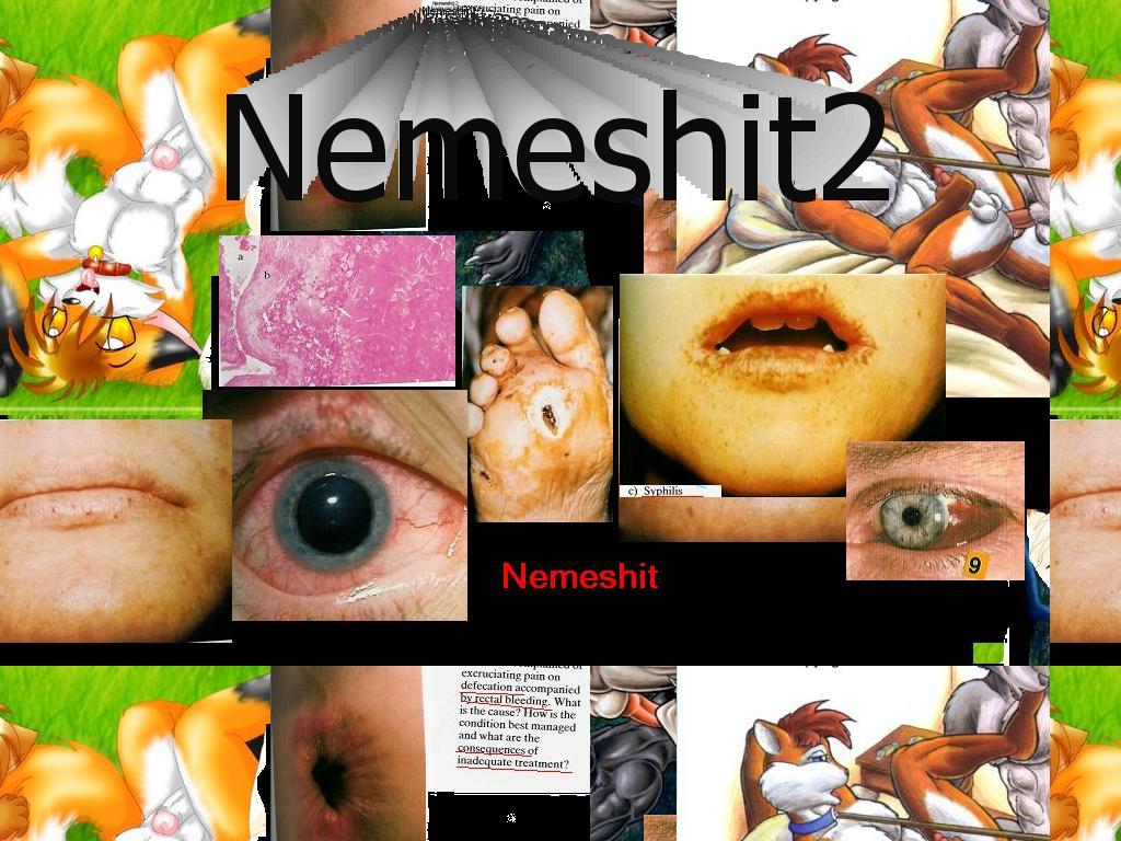 nemeshit2222222222