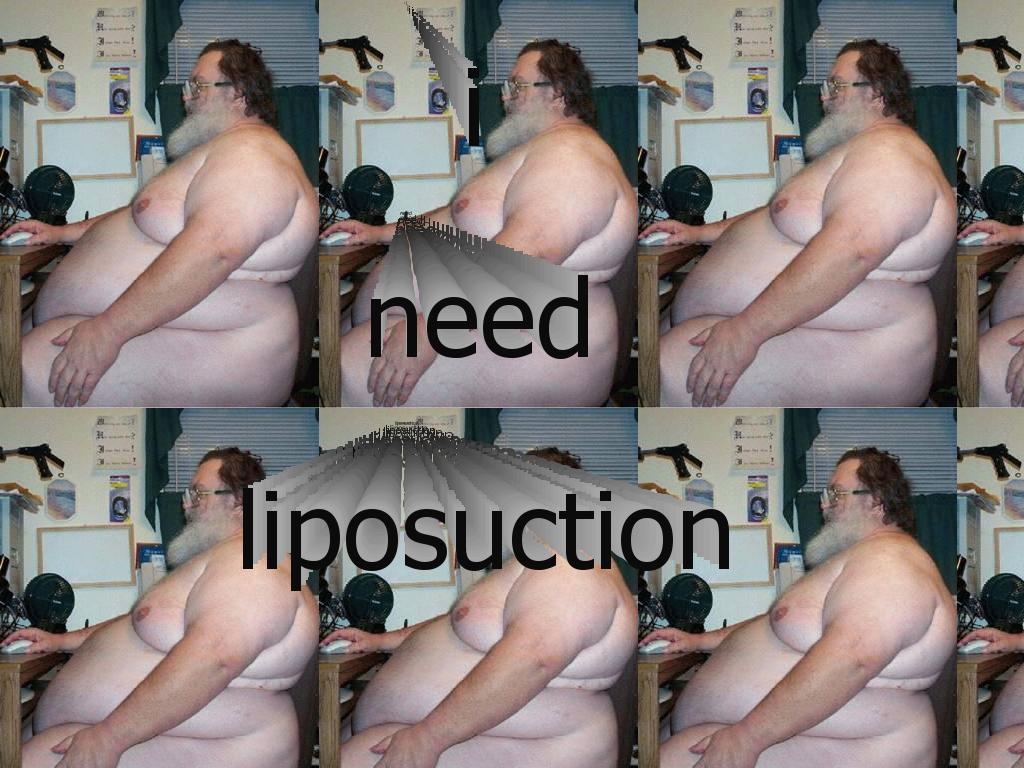 liposuction