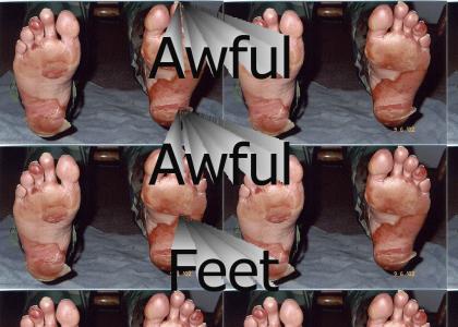 Nasty Feet
