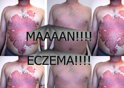 Scatman Hates Eczema!