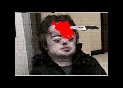 Brian Peppers Gets Stabbed