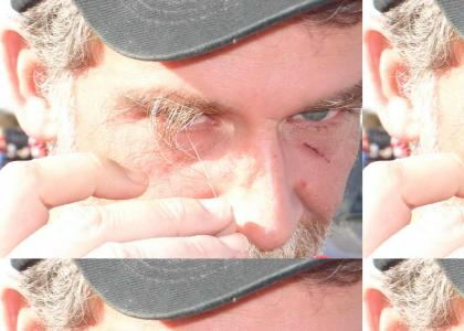 Bob Dole's Massive Eye Brow