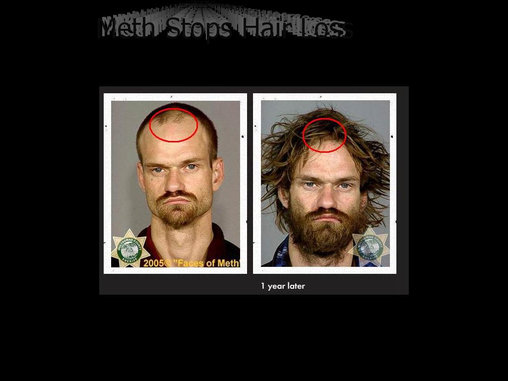 StopHairLossNow