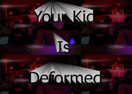 Your kid is deformed