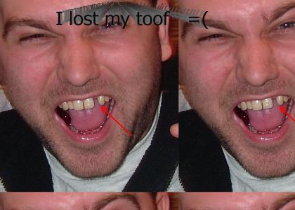 I LOST MY TOOTH!!