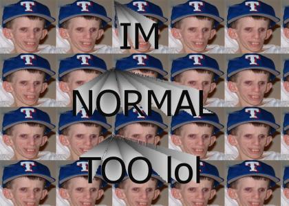 Im normal too.