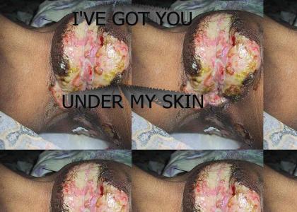 I'VE GOT YOU UNDER MY SKIN