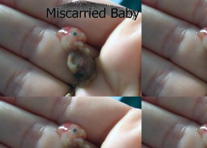 Miscarried Baby(dew)