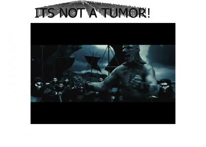 300 its not a tumor