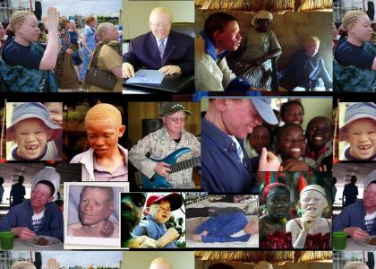 African albinos (revised)