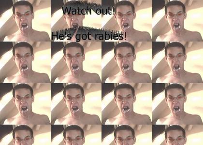Crazy dude has rabies!