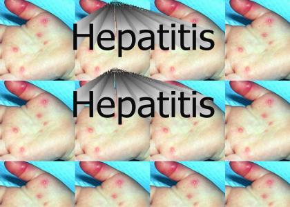 Hepatitis...
