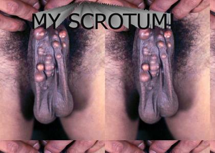 MY SCROTUM