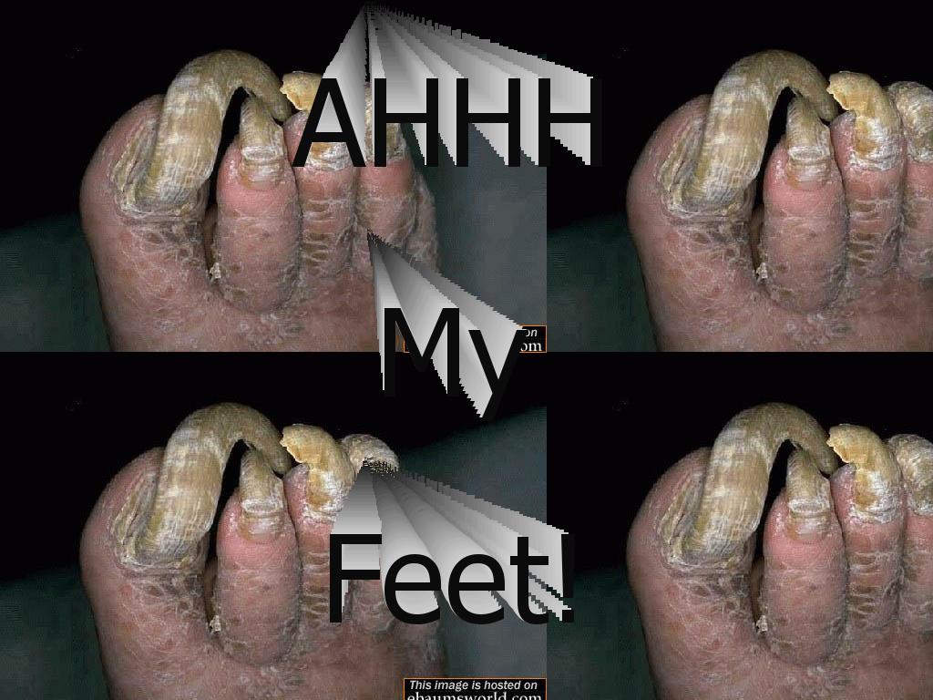 filthyfeet