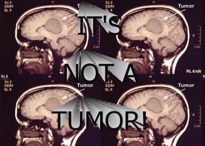 It's not a tumor!!!