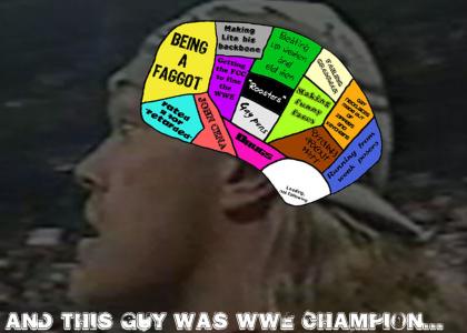 Edge's brain...