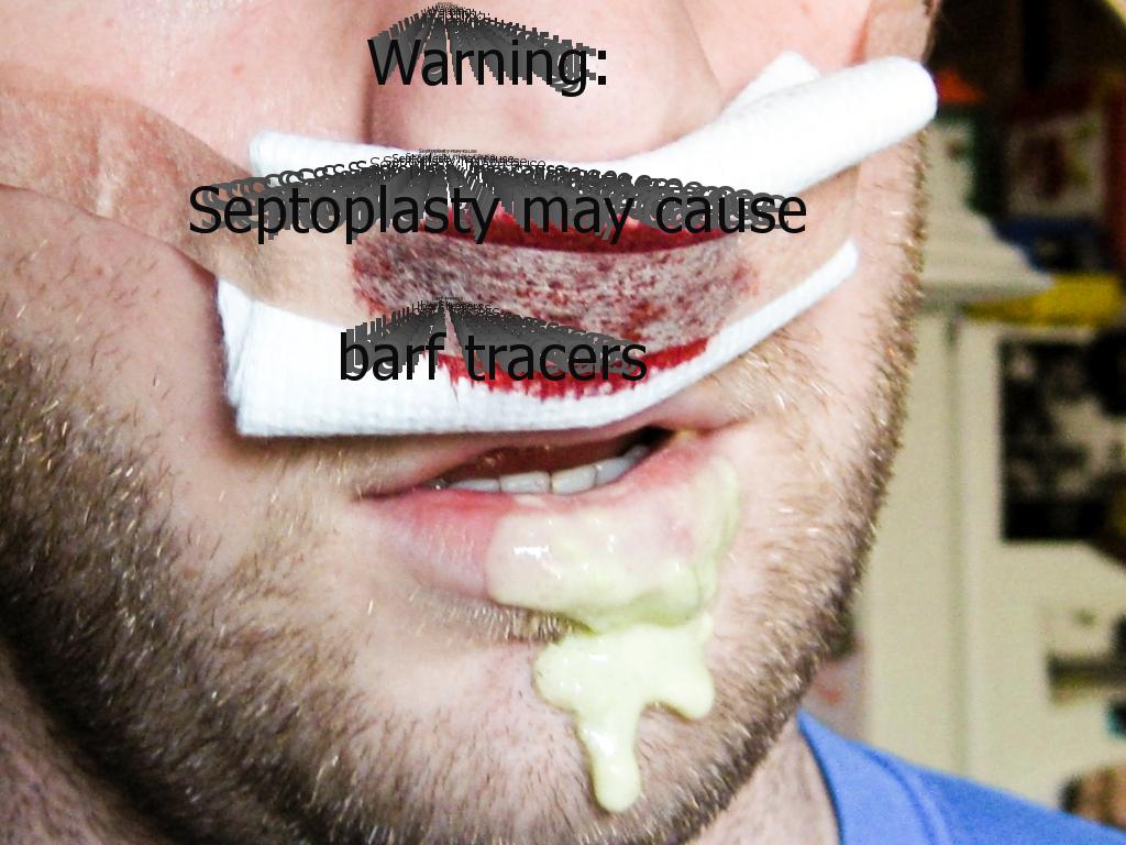 warningseptoplastymaycausebarftracers