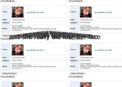 Face Transplant Woman Myspace Suicide