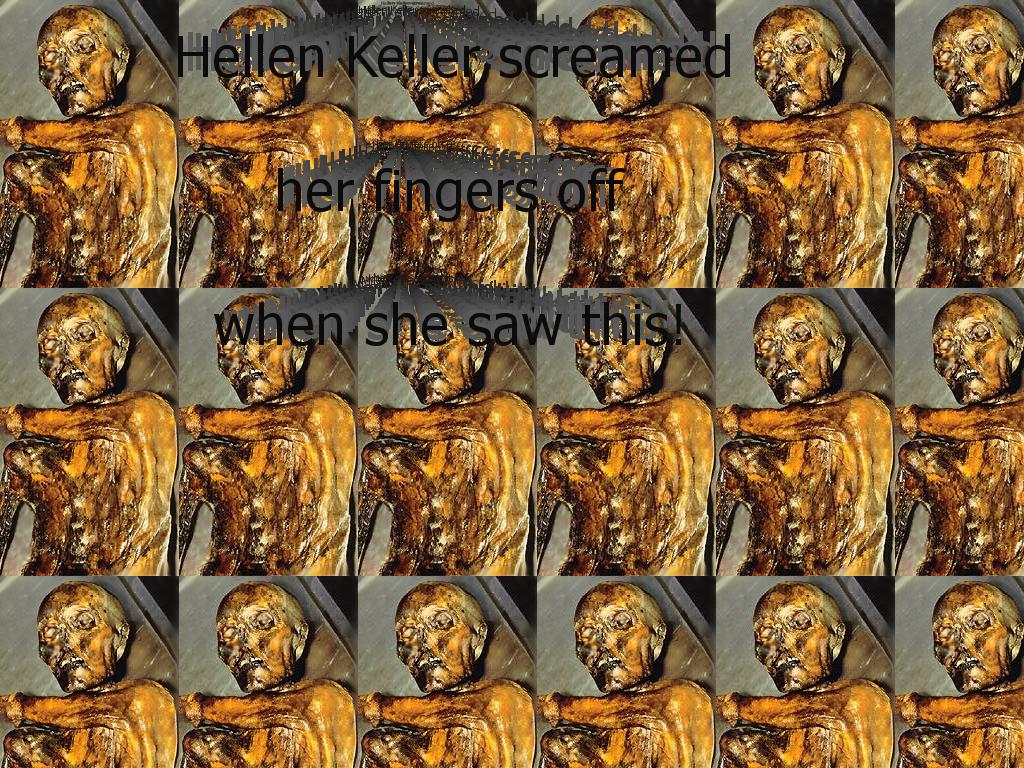 hellenkellerfingers