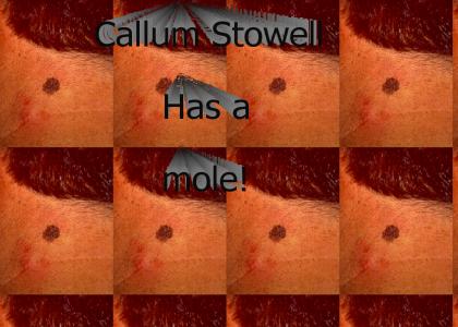 Callum Stowell, has a mole!