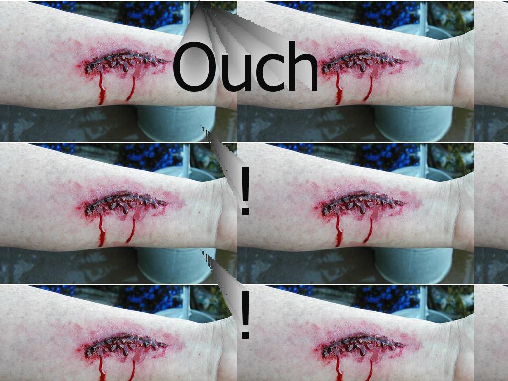 ouchicutmyarm