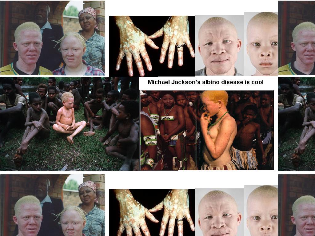 albinolife