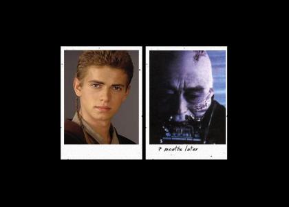 Anakin Skywalker did meth and all he got was a lousy suit (educational)