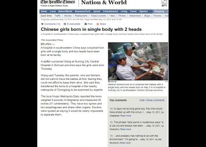 Chinese Girls Born With Two Heads On One Body