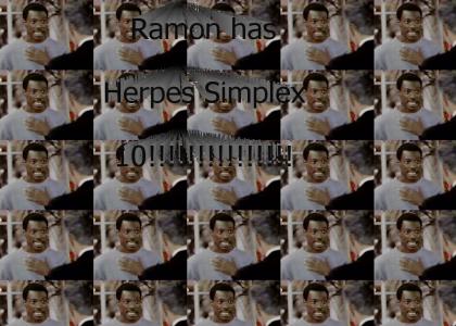 herpes simplex 10