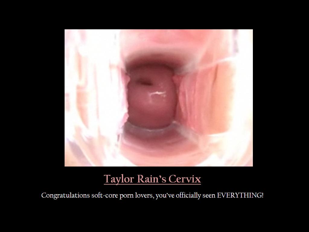 taylorrainscervix