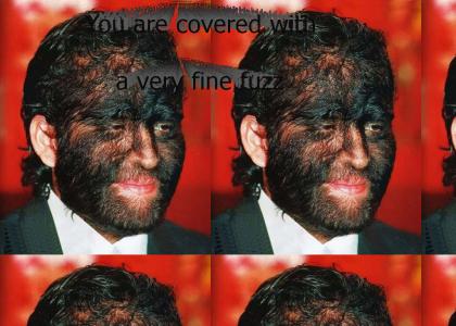 You are covered with a very fine fuzz