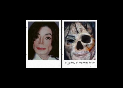 Michael Jackson did meth and all he got was a face full of scary.