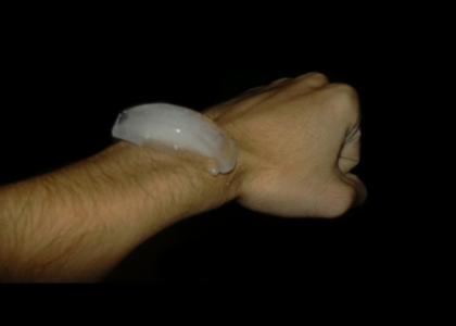 The ice on my wrist...