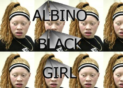 ALBINO BLACK GIRL (SFW NO PENIS)