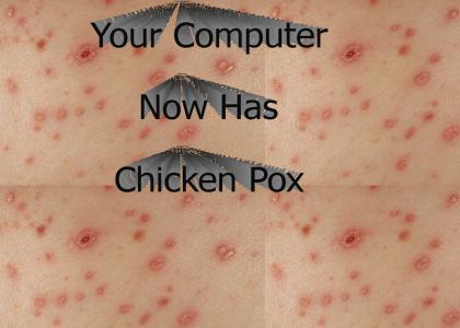 Computer Virus Chicken Pox Alert