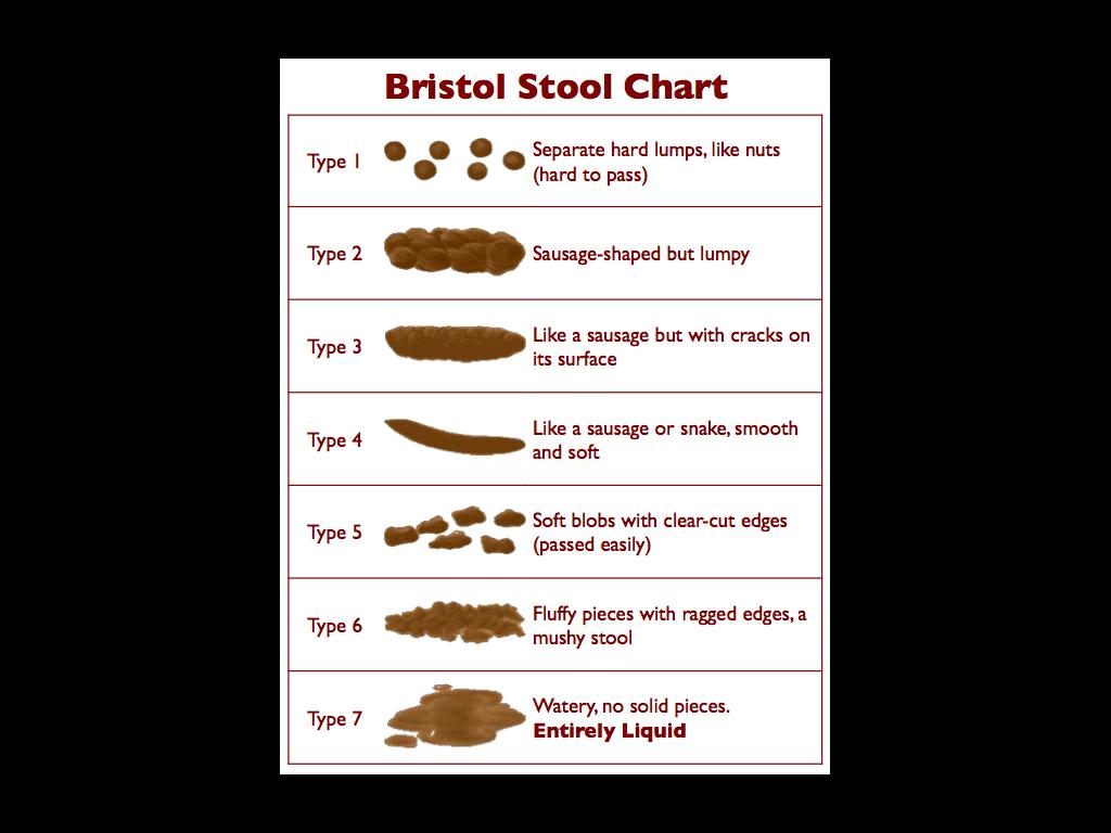 stoolscale