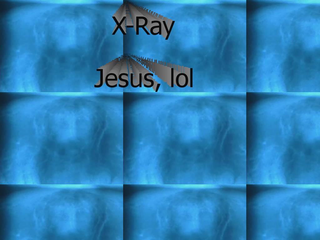 jesusxray